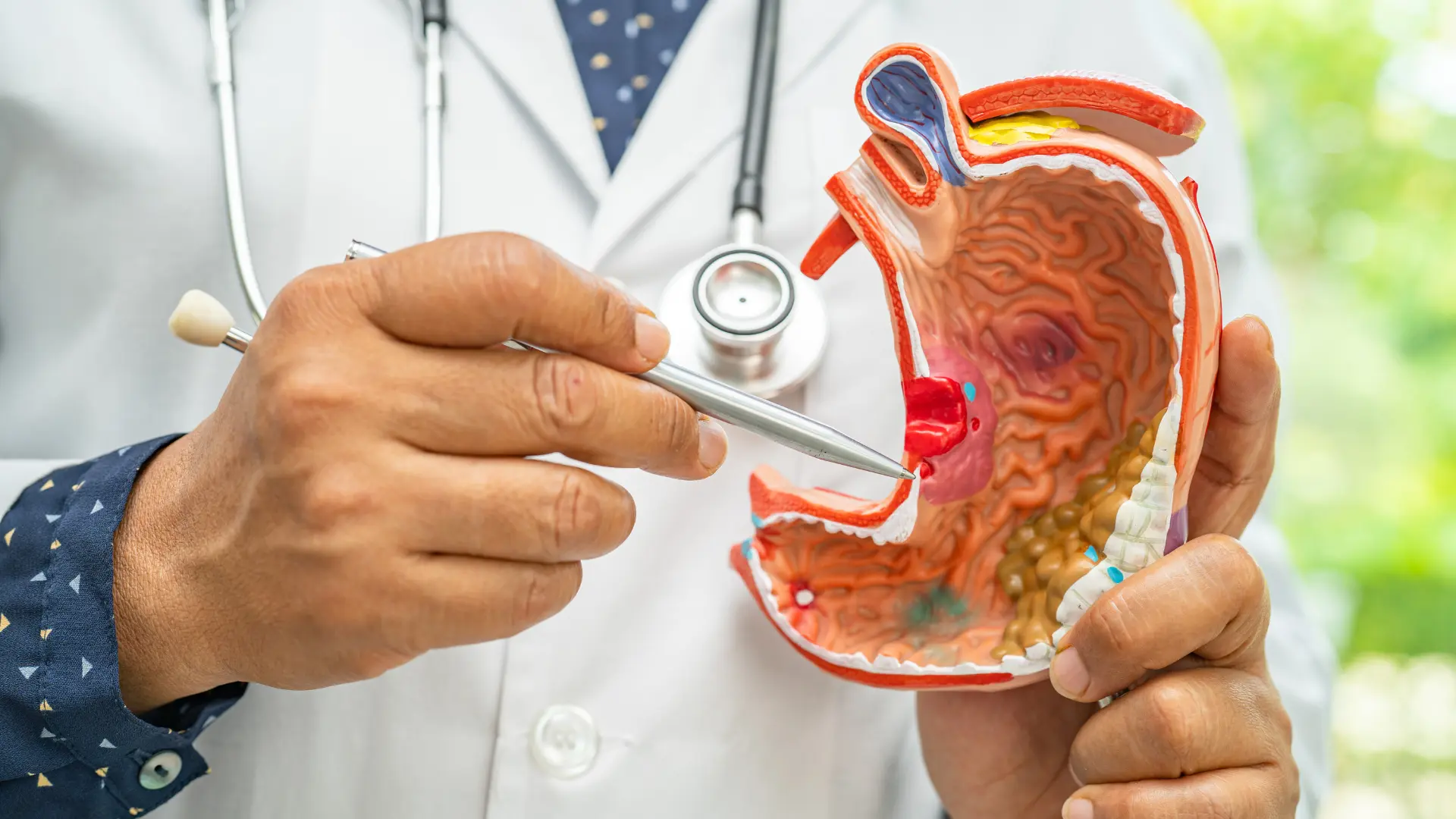 Cirurgia Metabólica